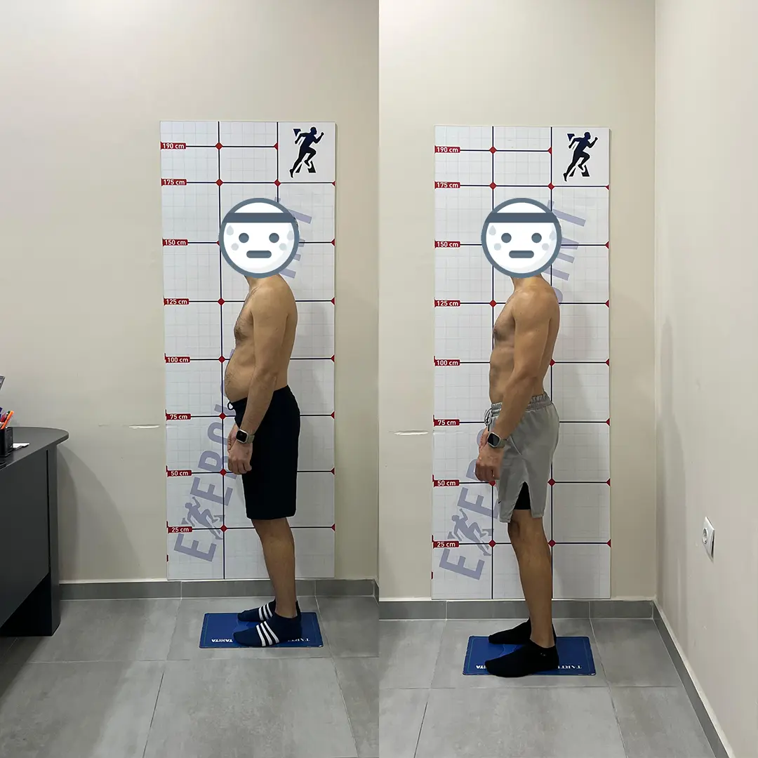 Bursa Nilüfer personal trainer öncesi sonrası sonuç