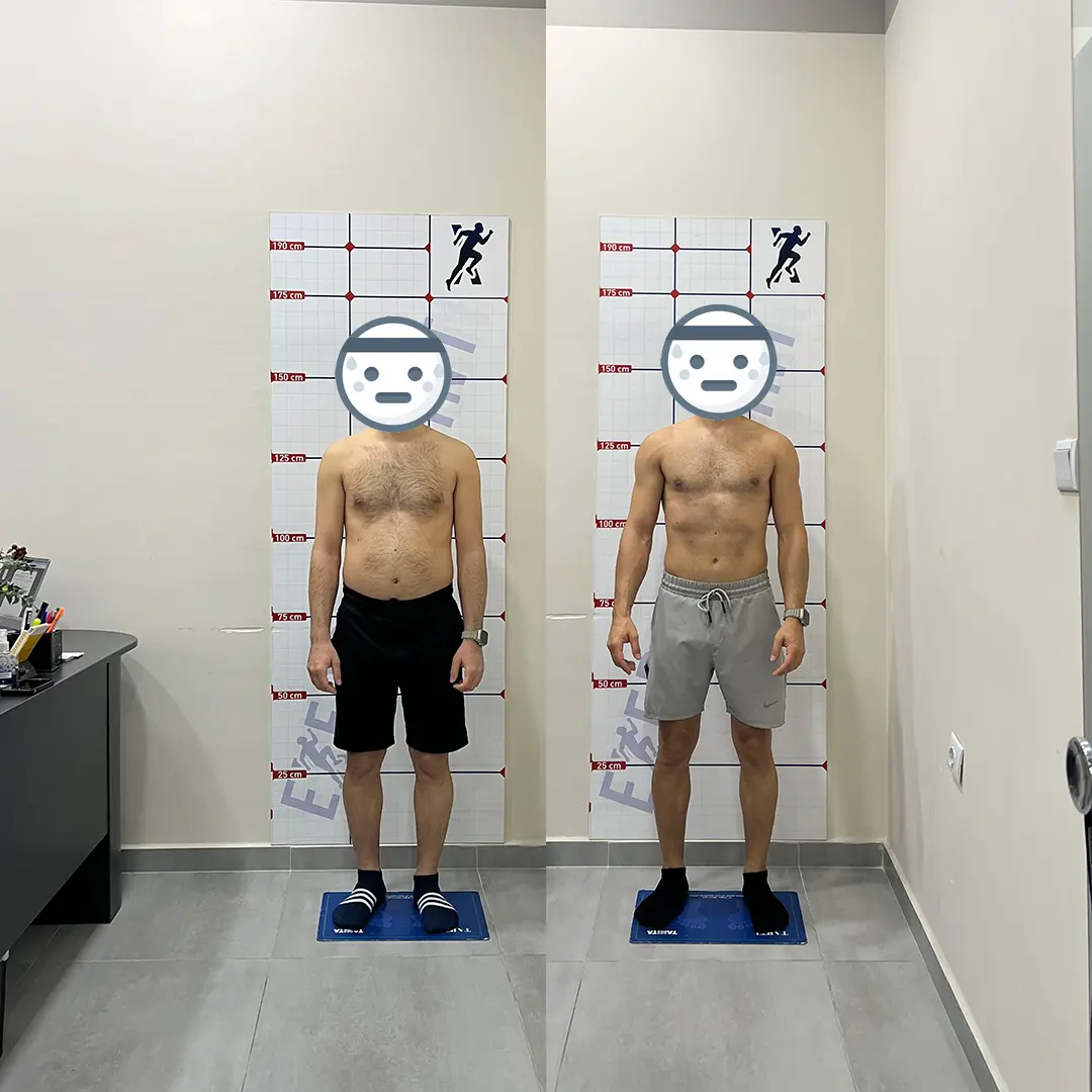 Öncesi Sonrası Bursa Personal Trainer – Nilüfer Fitness Değişim