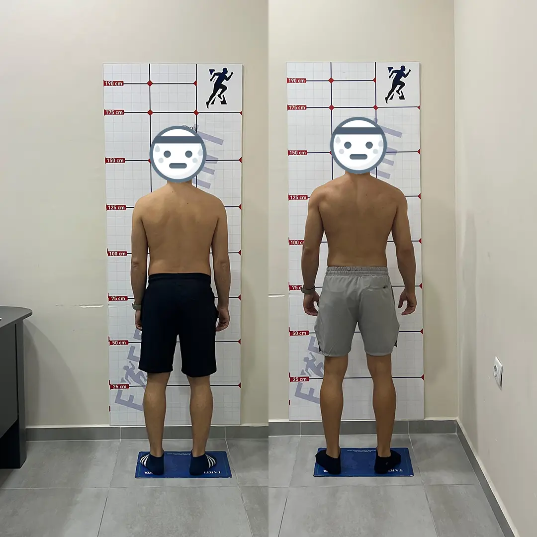 Öncesi Sonrası Bursa Personal Trainer – Yağ Kaybı ve Kas Kazanımı