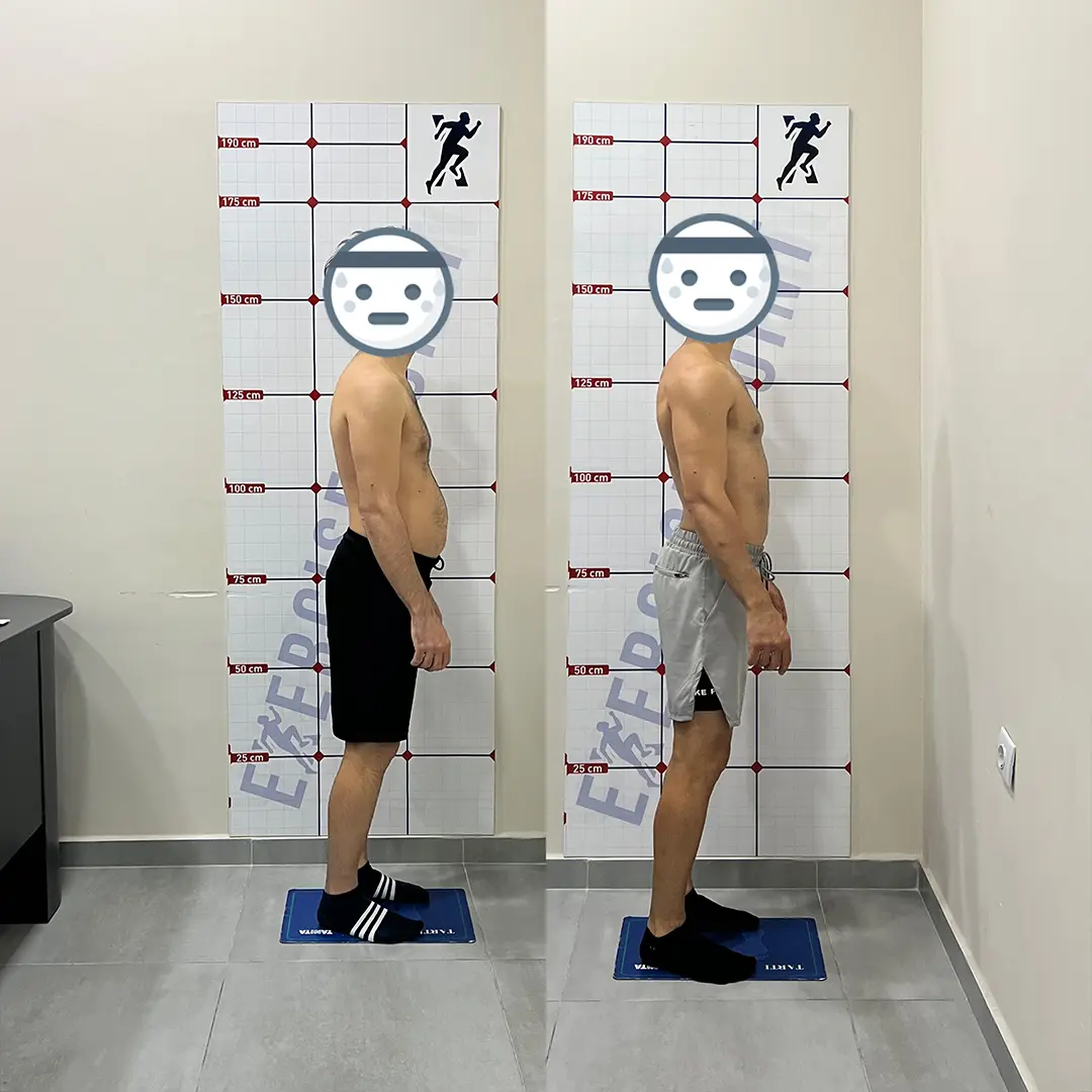 Öncesi Sonrası Bursa Personal Trainer – Erkek Danışan 3 Ay Sonuçları