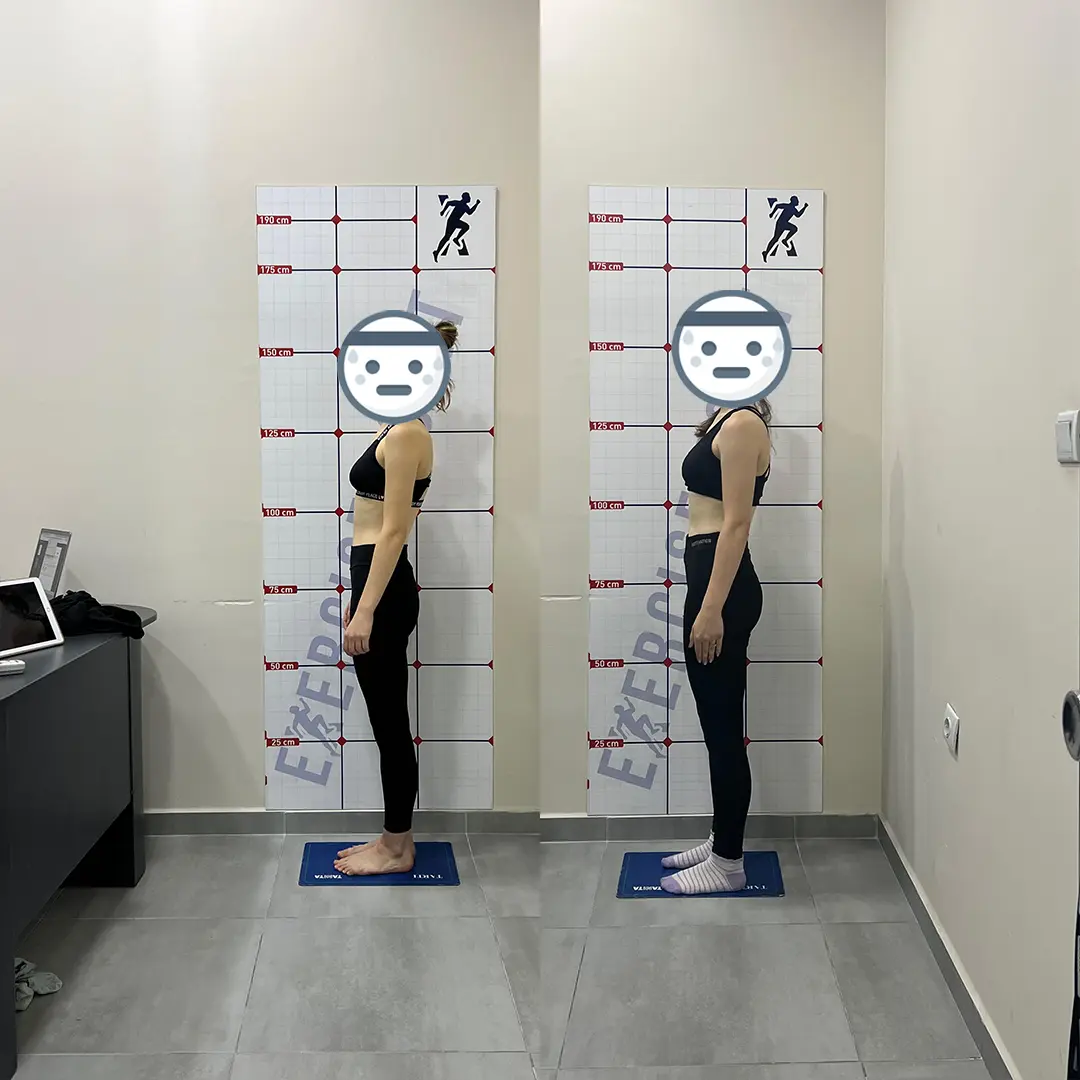 Öncesi Sonrası Bursa Personal Trainer – Kadın Danışan 6 Ay Sonuçları