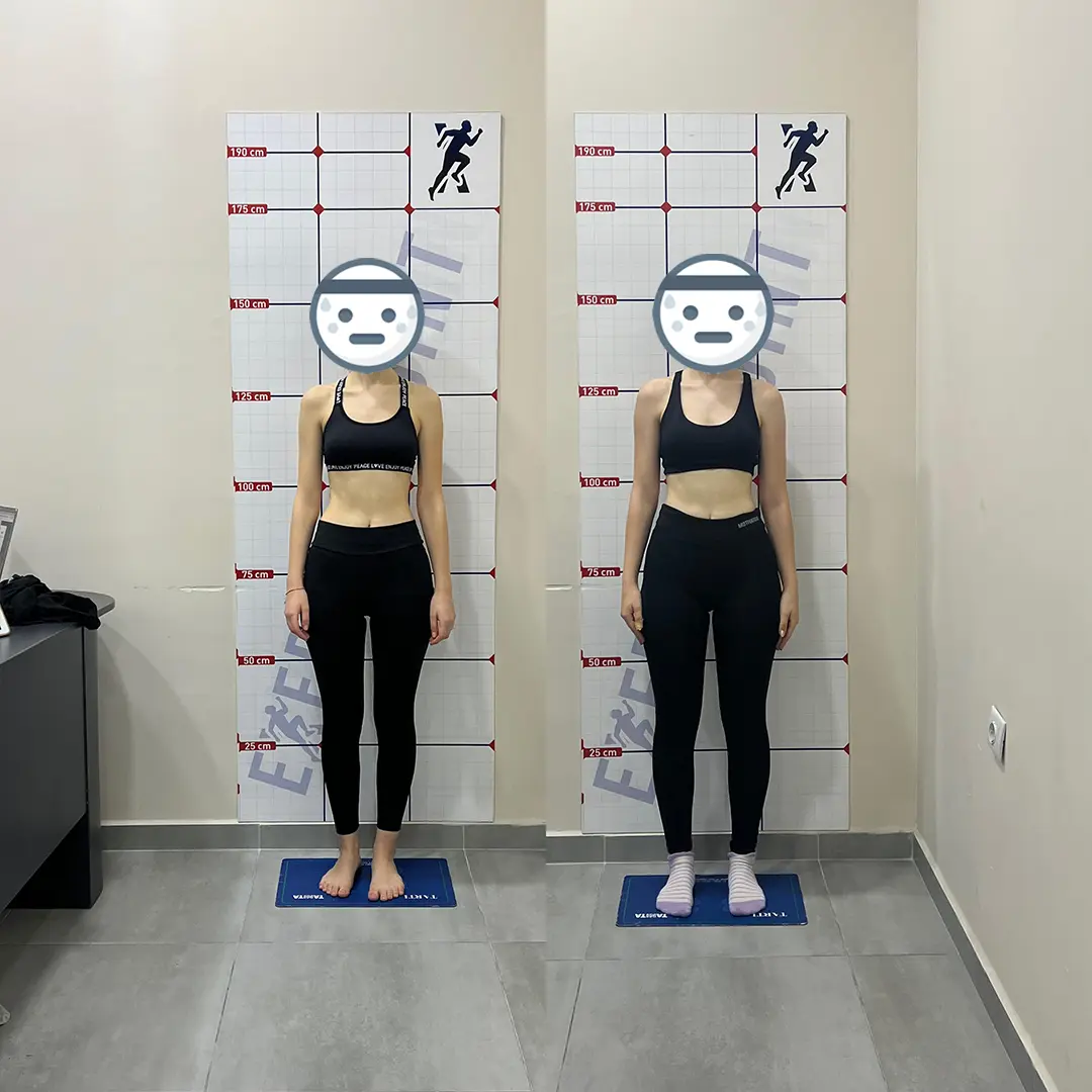 Öncesi Sonrası Bursa Personal Trainer – 5 Ayda Vücut Gelişimi