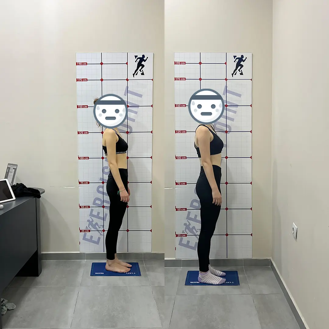 Öncesi Sonrası Bursa Personal Trainer – Öğrencinin 4 Aylık Dönüşümü