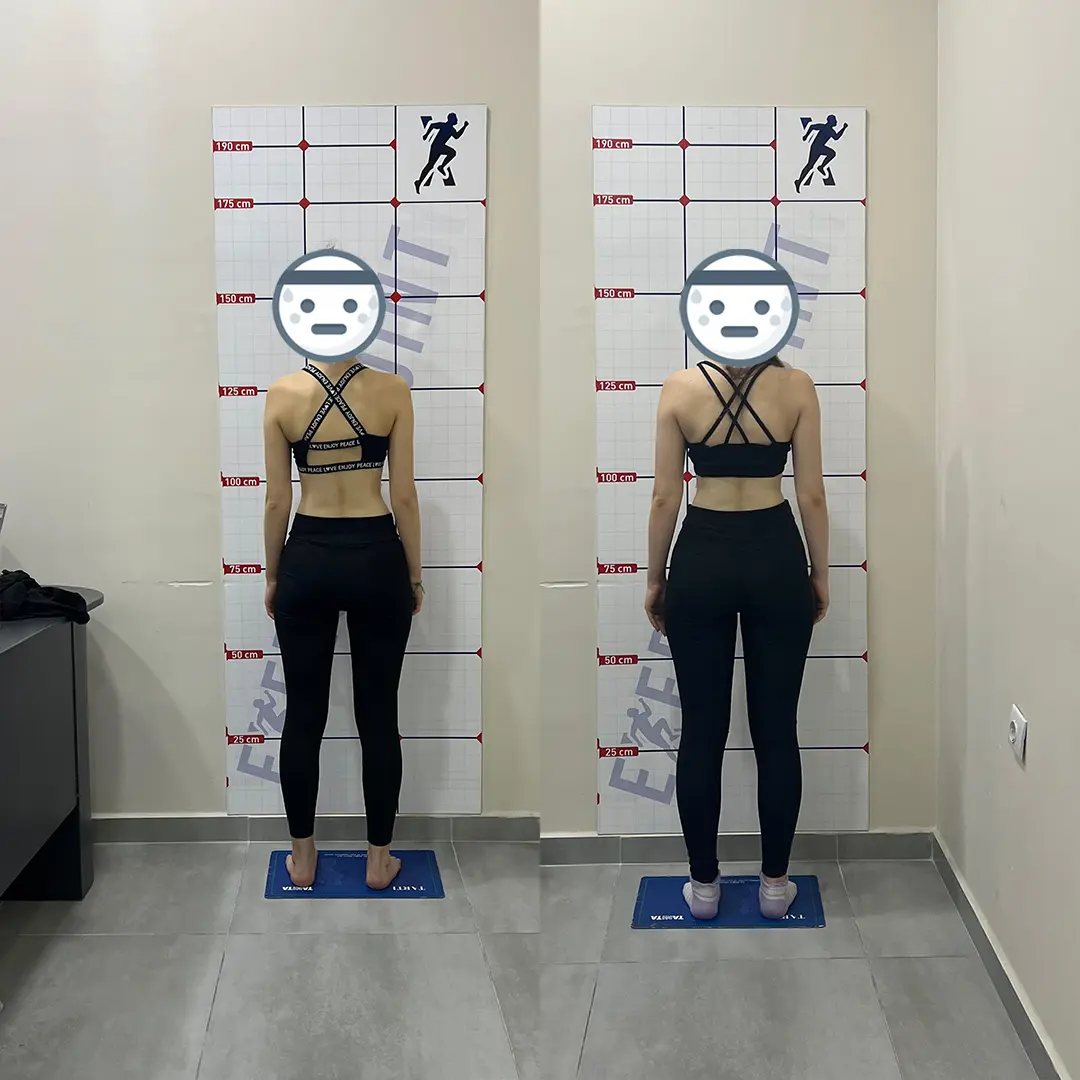 Öncesi Sonrası Bursa Personal Trainer – 3 Ayda Fit Görünüm