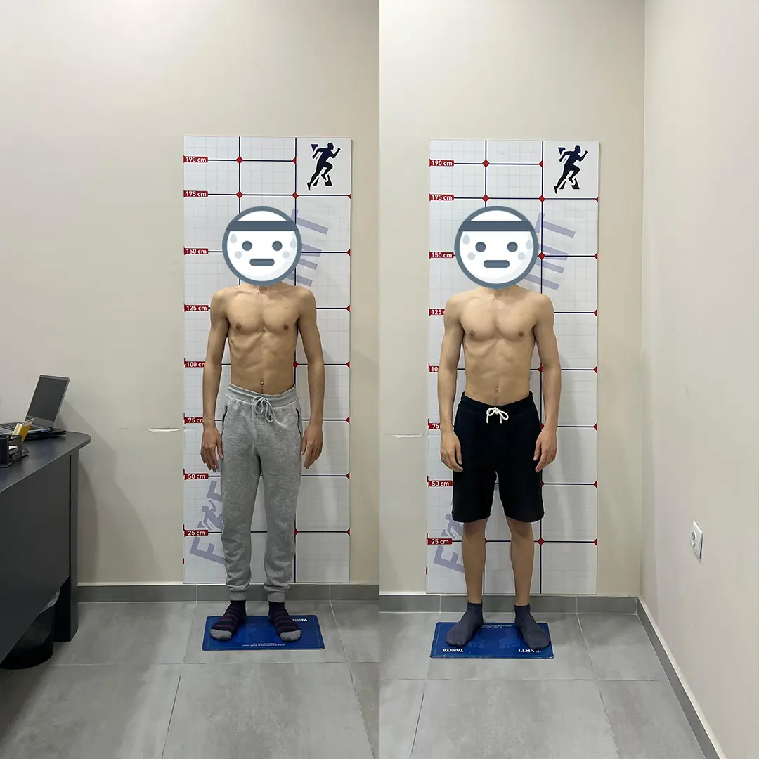 Öncesi Sonrası Bursa Personal Trainer – 2 Ayda Elde Edilen Sonuç