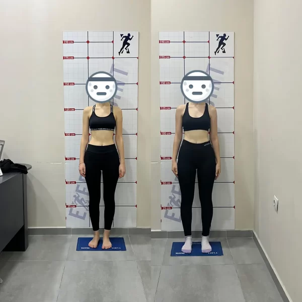 Öncesi Sonrası Bursa Personal Trainer – 5 Ayda Vücut Gelişimi